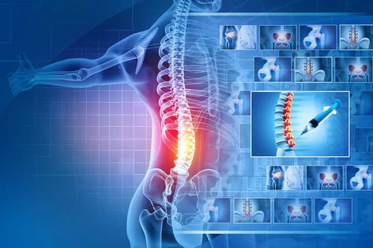 Interventions - Pacific Pain and Spine
